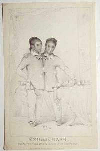 Eng and Chang, The Celebrated Siamese Youths.